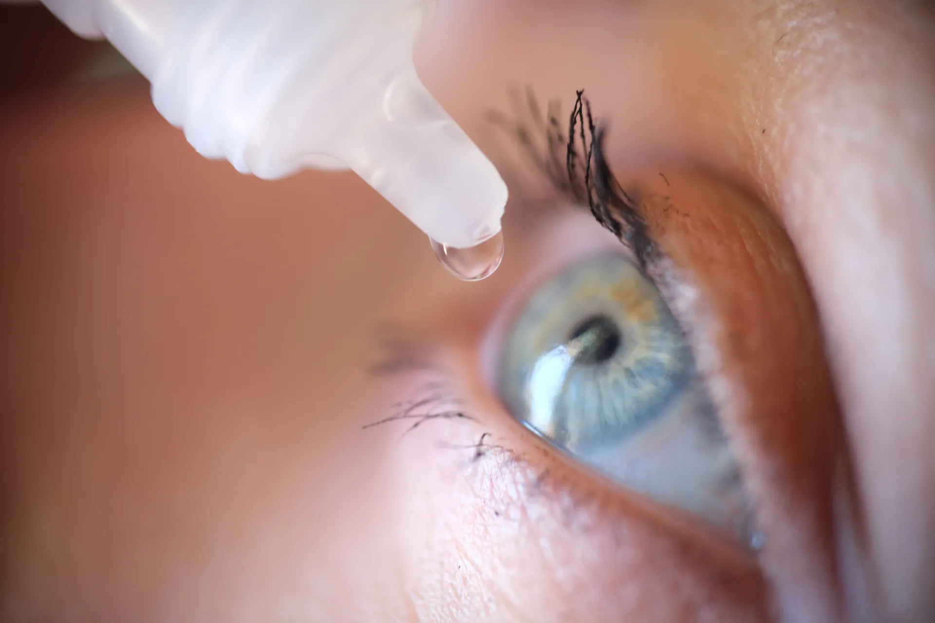 Augentropfen werden in ein Auge getropft