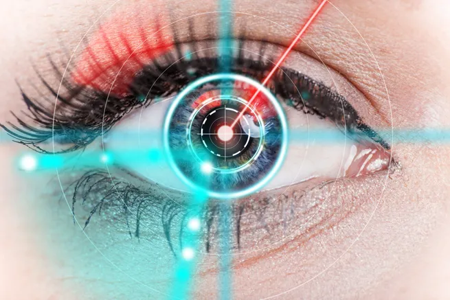 Augenlasern