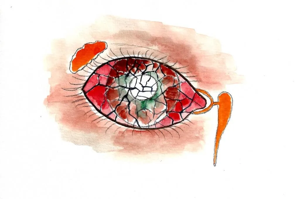 Trockenes Auge